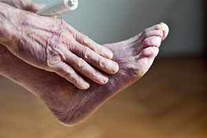 When Poor Circulation Hurts