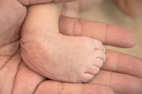 Helping Children With Clubfoot Lead Active Lives